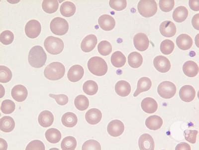 blood tear cells dc